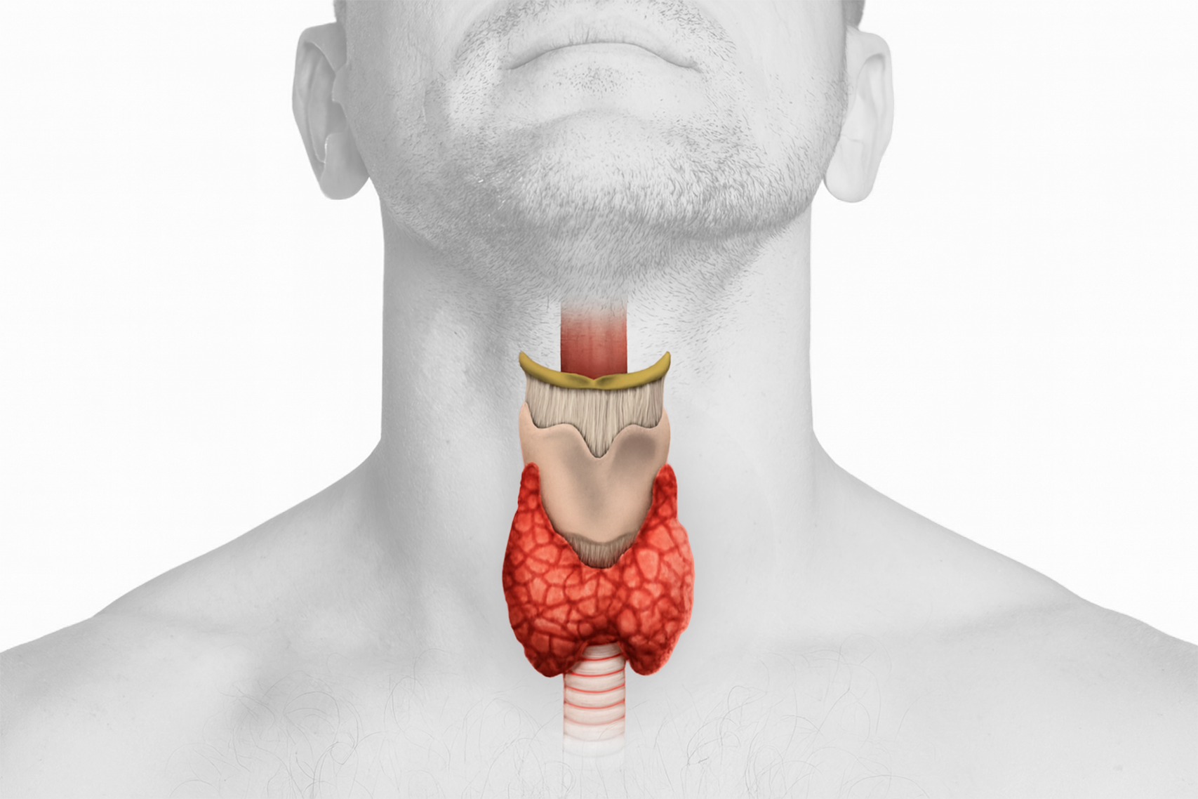 thyroide